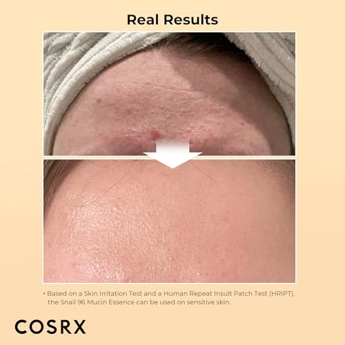 COSRX Snail Mucin 96% Power Repairing Essence 3.38 fl.oz 100ml, Hydrating Serum for Face with Snail Secretion Filtrate for Dull Skin & Fine Lines, Korean Skin Care - Image 3